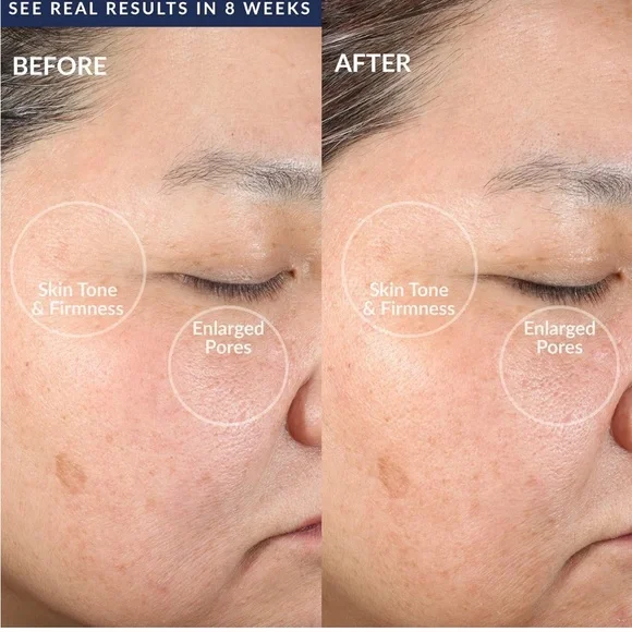 PMD Clean - Picture 3 of 12